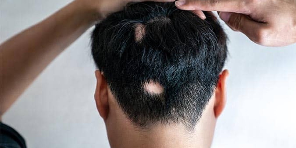 Total Skin & Hair Revival: Expert Laser Resurfacing and Alopecia Treatment Solutions Near You