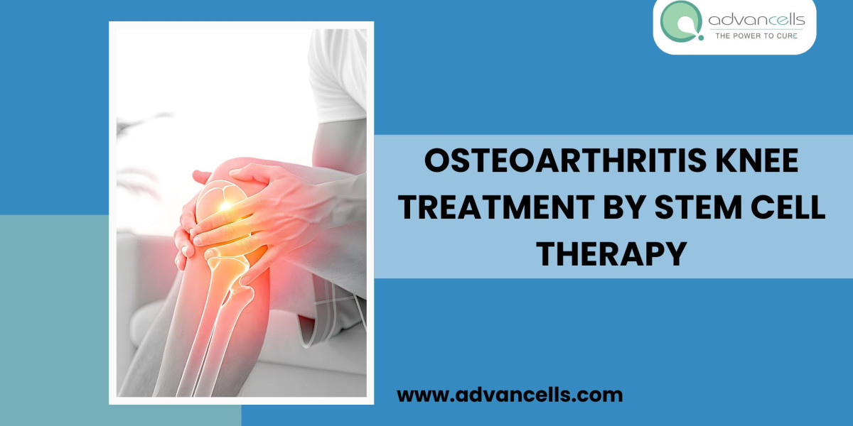 Osteoarthritis Knee Treatment by Stem Cell Therapy
